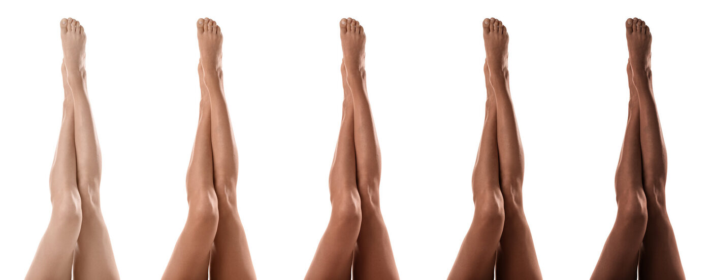 Person with healthy legs after varicose vein treatment at Nelson Vein Clinic