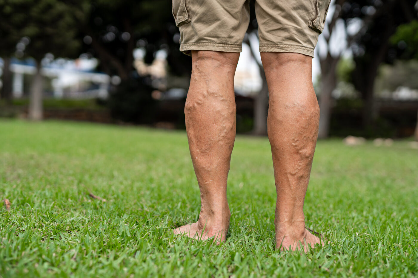 Specialist performing minimally invasive vein treatment procedure