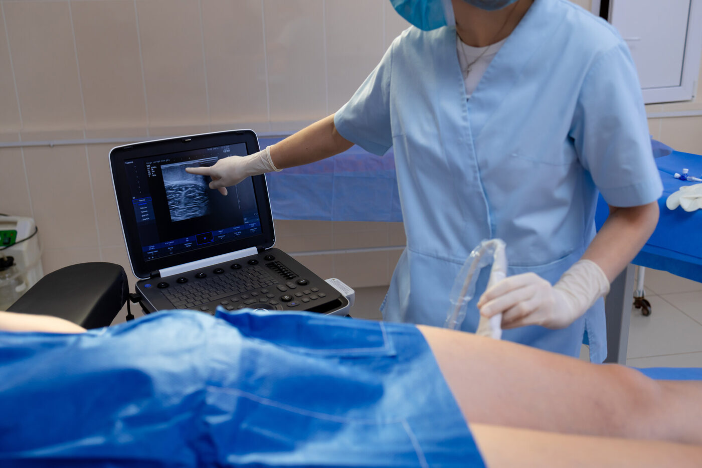 Ultrasound guided vein scan during treatment